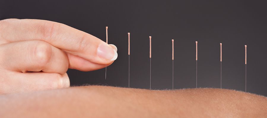 acupuncture points